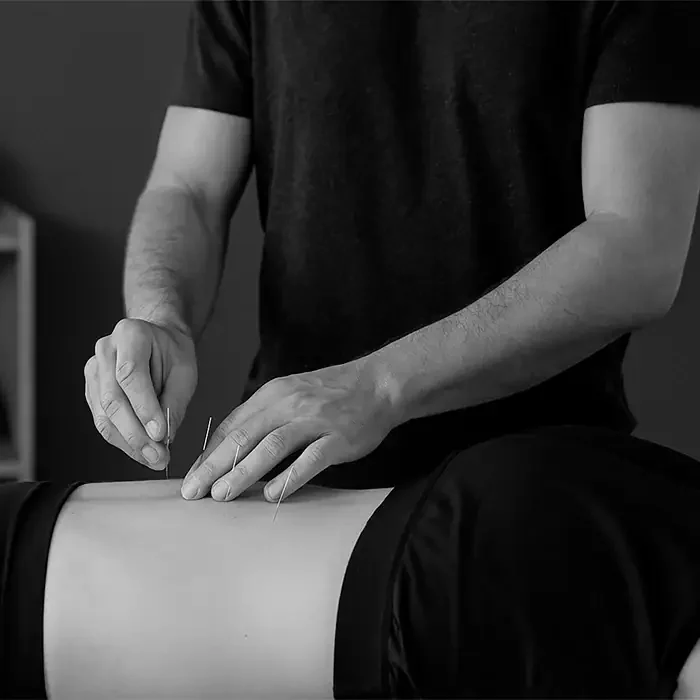 Acupuncture for low back pain.